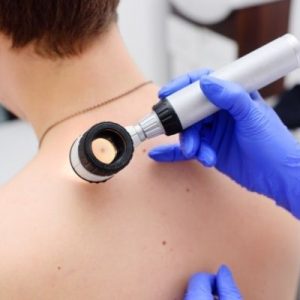 4 Important Ways To Protect Yourself from Skin Cancer